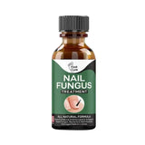 Nail Repair Serum – Fast Fungus Treatment (Natural Formula)