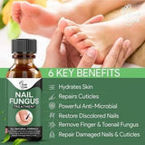 Nail Repair Serum – Fast Fungus Treatment (Natural Formula)