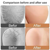 Anti Crack Silicone Heel Protector Socks
